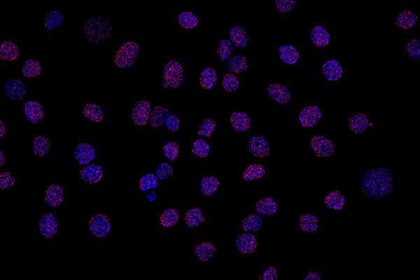 NaveniFlex Cell MR RED