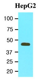 Anti-MAT2A, clone 3A2