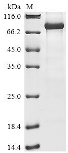 E3 ubiquitin-protein ligase RNF168 (RNF168), human, recombinant