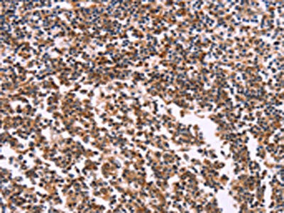 Anti-MSMO1