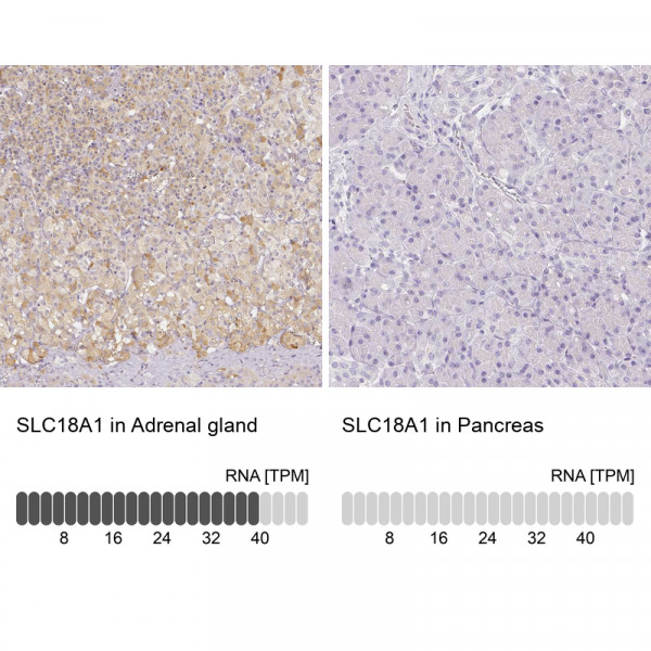 Anti-SLC18A1