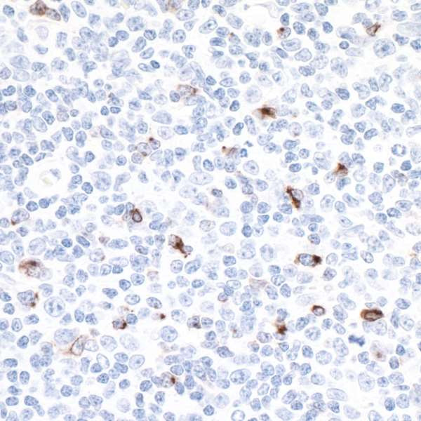 Anti-LAG3 Recombinant Monoclonal