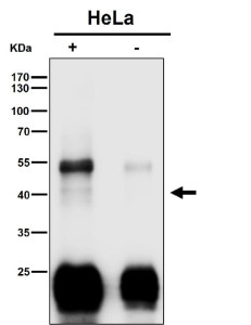 Anti-Clu / Clusterin, clone 30C68