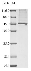 Serine/threonine-protein kinase CAK1 (CAK1), Saccharomyces cerevisiae, recombinant