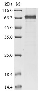 Genome polyprotein, partial, West Nile virus, recombinant