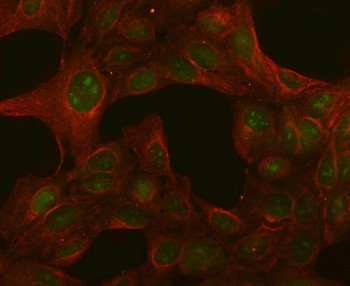 Anti-PGLS / 6-phosphogluconolactonase / 6PGL