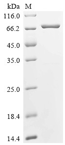 Glutathione S-transferase class-mu 26 kDa isozyme, Biotinylated, Schistosoma japonicum, recombinant