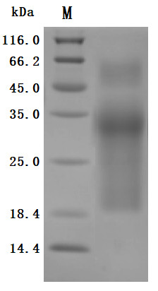 Mucin-17 (MUC17), partial (Active), human, recombinant