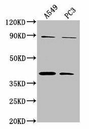 Anti-ATP6V0D2