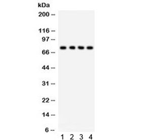 Anti-TNF Receptor II / TNFR2