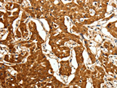 Anti-CDH23