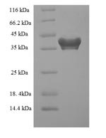 Programmed cell death protein 10 (PDCD10), human, recombinant