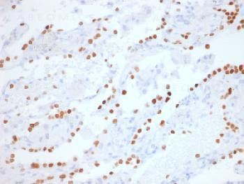 Anti-TTF-1 / NKX2.1 (Thyroid &amp; Lung Epithelial Marker) Recombinant Rabbit Monoclonal Antibody (clone
