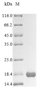 Solute carrier family 2, facilitated glucose transporter member 1 (SLC2A1),partial, human, recombina