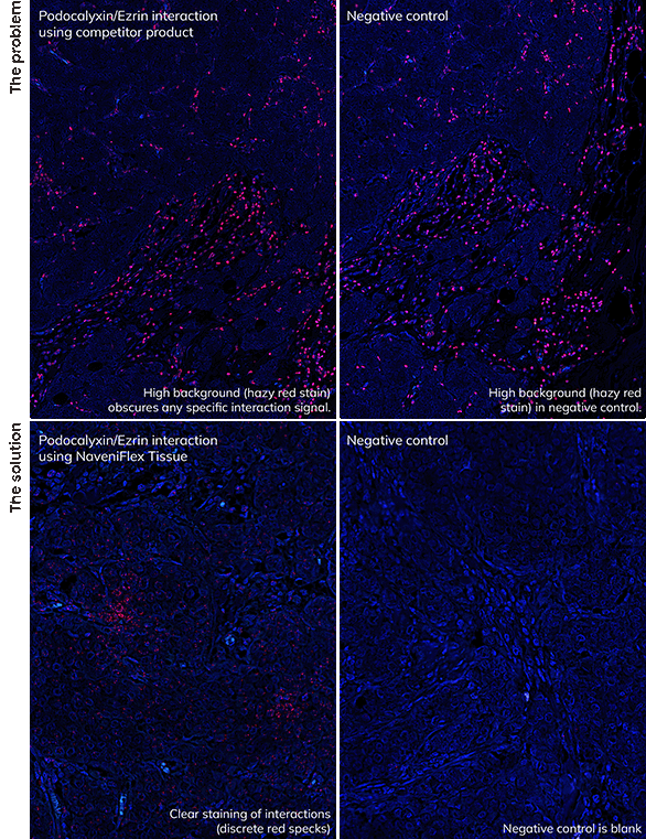 NaveniFlexTissue