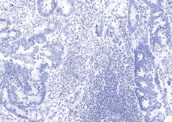 Anti-FOXP3 Monoclonal Antibody