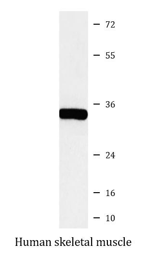 Anti-SGCG / gamma Sarcoglycan
