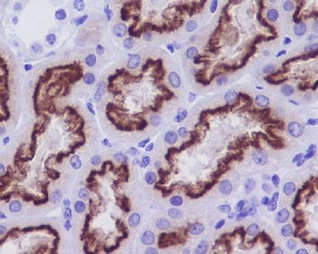 Anti-Cubilin / CUBN, clone GA-3