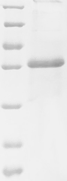 Protein B5 (PS/HR), partial, Vaccinia virus, recombinant