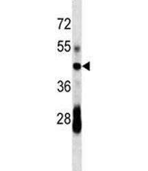 Anti-CD79a, clone 299CT22.1.2