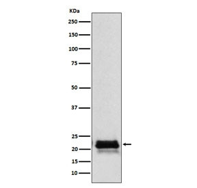 Anti-FSH beta, clone AFGI-6