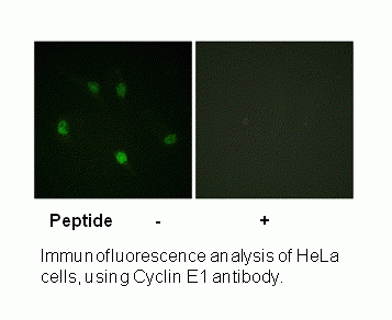 Anti-Cyclin E1 (Ab-77)