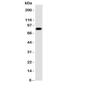 Anti-Proprotein Convertase 4