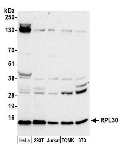 Anti-RPL30/Ribosomal Protein L30