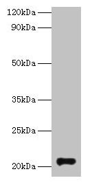 Anti-GM2A