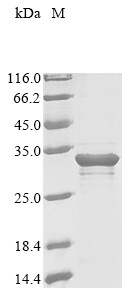 Myocilin (Myoc), partial, mouse, recombinant