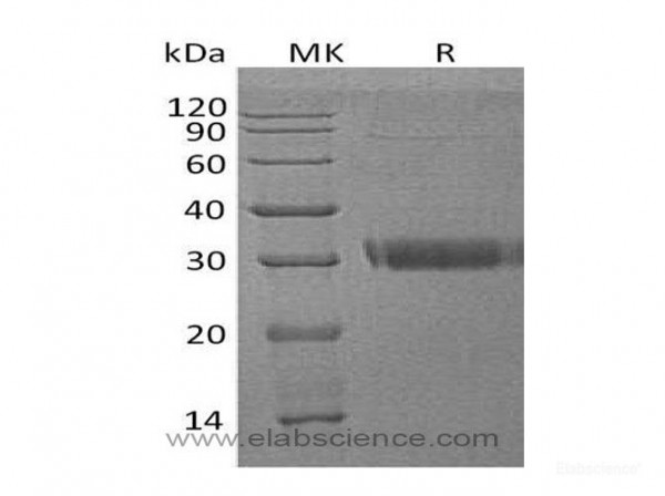 Adiponectin/ACRP30/ADIPOQ Protein(C-6His) (recombinant human)