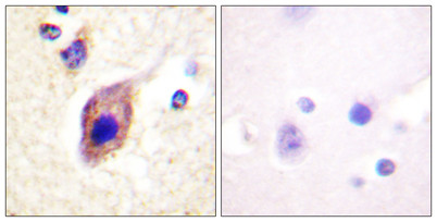 Anti-PLC gamma2