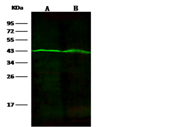 Anti-Fumarate Hydratase/FH Monoclonal Antibody