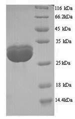 TATA-box-binding protein (SPT15), Saccharomyces cerevisiae, recombinant