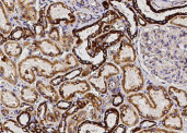 Anti-SOD2 Monoclonal Recombinant Antibody