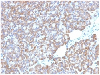 Anti-LMO2 / Rhombotin 2, clone LMO2/1972