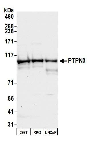 Anti-PTPN3