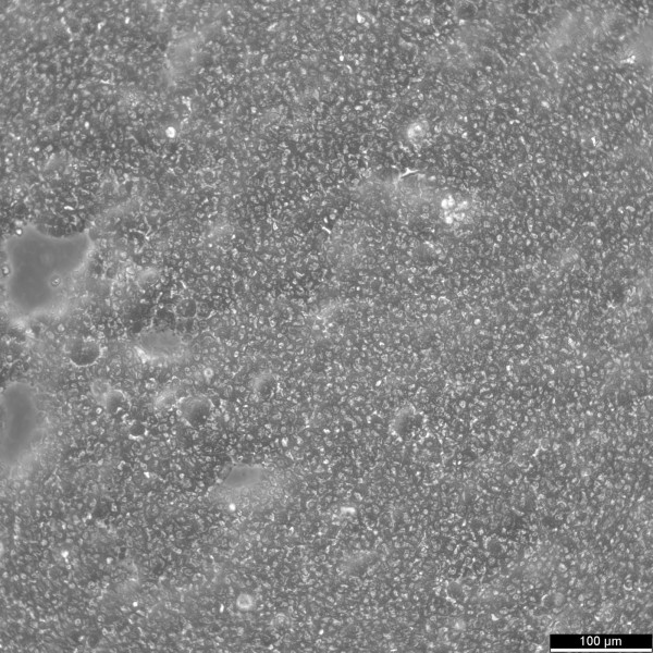 B-LCL-HROC285 Cells