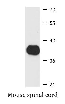 Anti-SIRT2