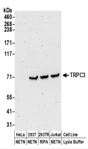 Anti-TRPC3