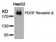 Anti-PDGF Receptor beta (Ab-751)