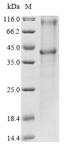 Ceramide glucosyltransferase (UGCG), human, recombinant