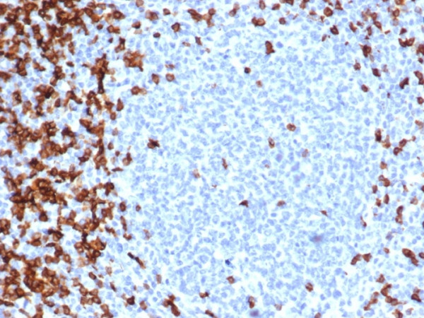 Anti-CD7 (T-Cell Leukemia Marker), recombinant antibody, clone CD7/6388R