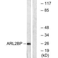 Anti-ARL2BP