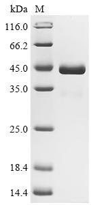 Envelopment polyprotein (GP), partial, recombinant Crimean-Congo hemorrhagic fever virus