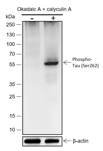 Anti-Recombinant Phospho-Tau (S262), clone A408