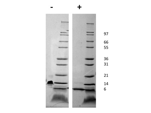 Stromal Cell-Derived Factor-1 alpha (CXCL12)