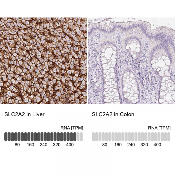 Anti-SLC2A2
