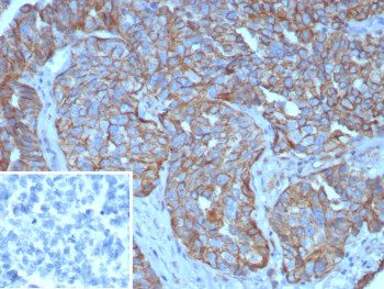 Anti-MUC16 / CA125, clone CA125/8894