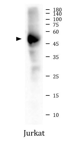 Anti-CD5, clone SQab20184